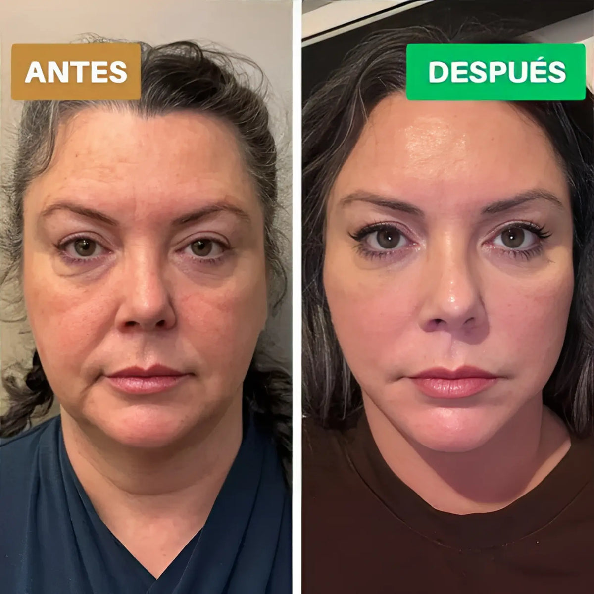 Lunmia™ Cepillo de Drenaje Linfático Facial