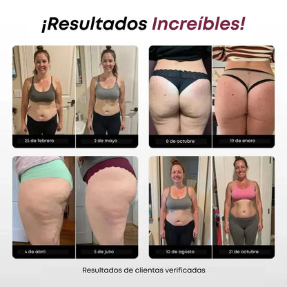 Lunmia™ Legging 3D – Redefine tu silueta sin esfuerzo